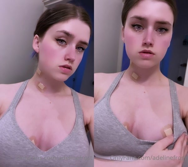 adelinefrost - super sexy being covered in bandaids