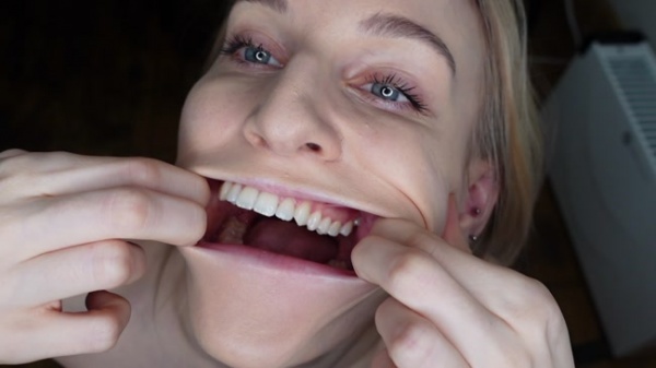 Sofie Skye - Teeth And Molars Tour Dental History