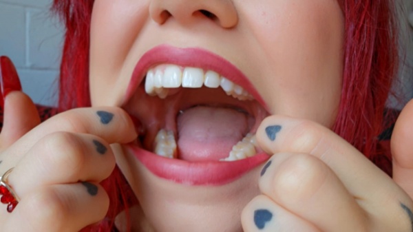 Ginger Rae xoxo - Teeth and Cavity Inspection - Tooth Fetish - Ginger Rae