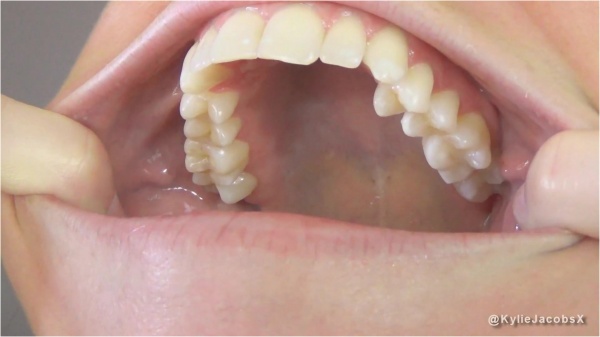 Kylie JacobsX - After My Dentist Appointment